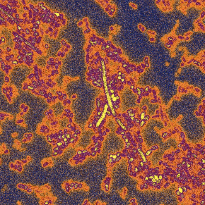 Bacteroides del intestino.
Foto de Kevin Cutler (Mougous Lab, University of Washington, School of Medicine)